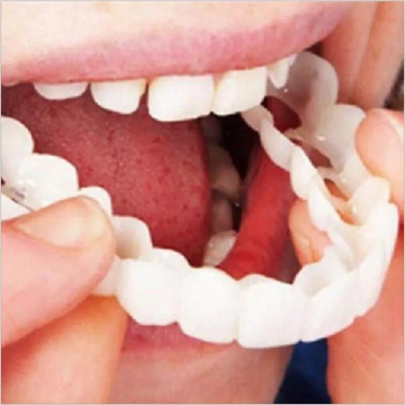 Viral Adjustable Snap-On-Dentures